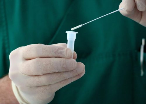 Tos y dolor de garganta: ¿Cómo saber si debo realizarme una prueba de coronavirus?