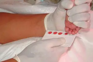 Tamizaje neonatal
