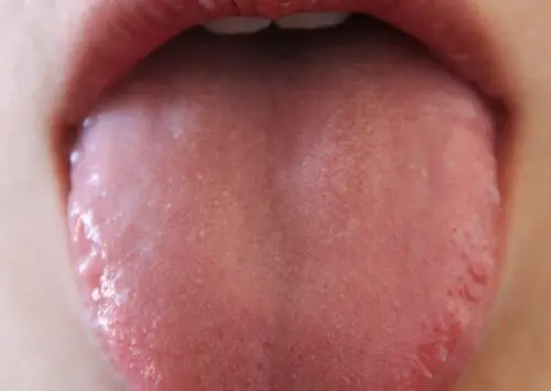 Blanco, negro, rojo… Lo que el color de tu lengua dice sobre tu estado de salud, explicado por expertos de Harvard